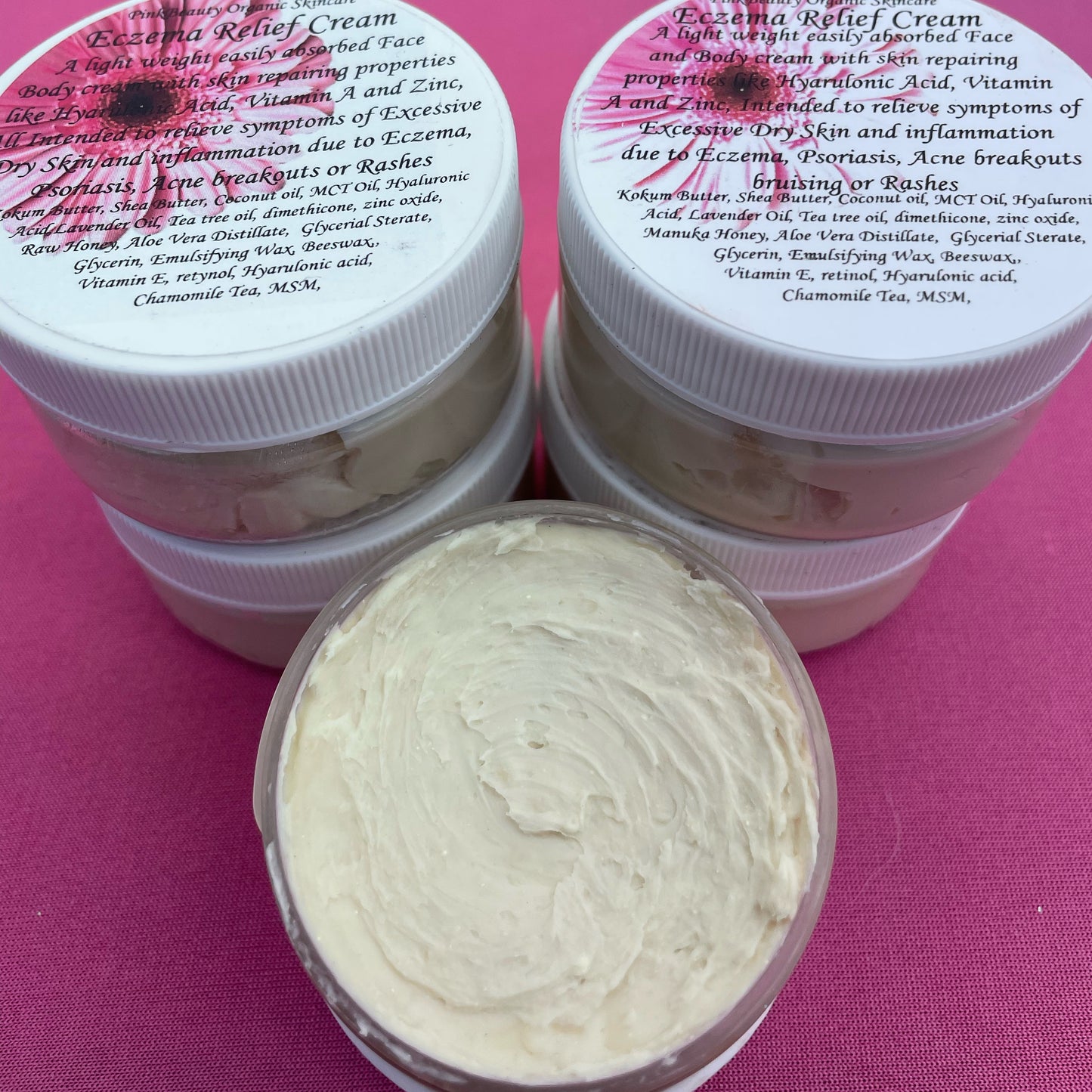 Eczema Relief Cream ( dry itchy skin )