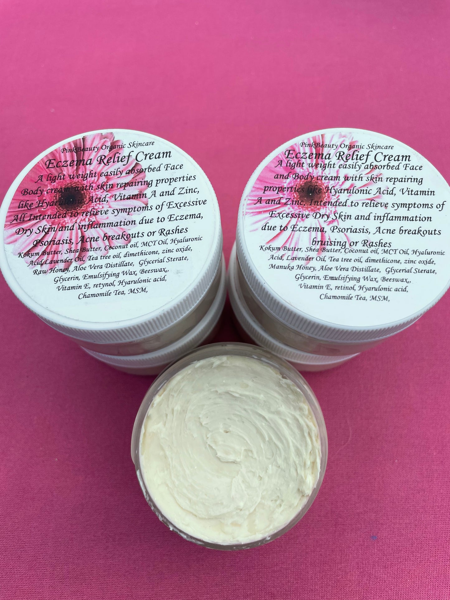 Eczema Relief Cream ( dry itchy skin )