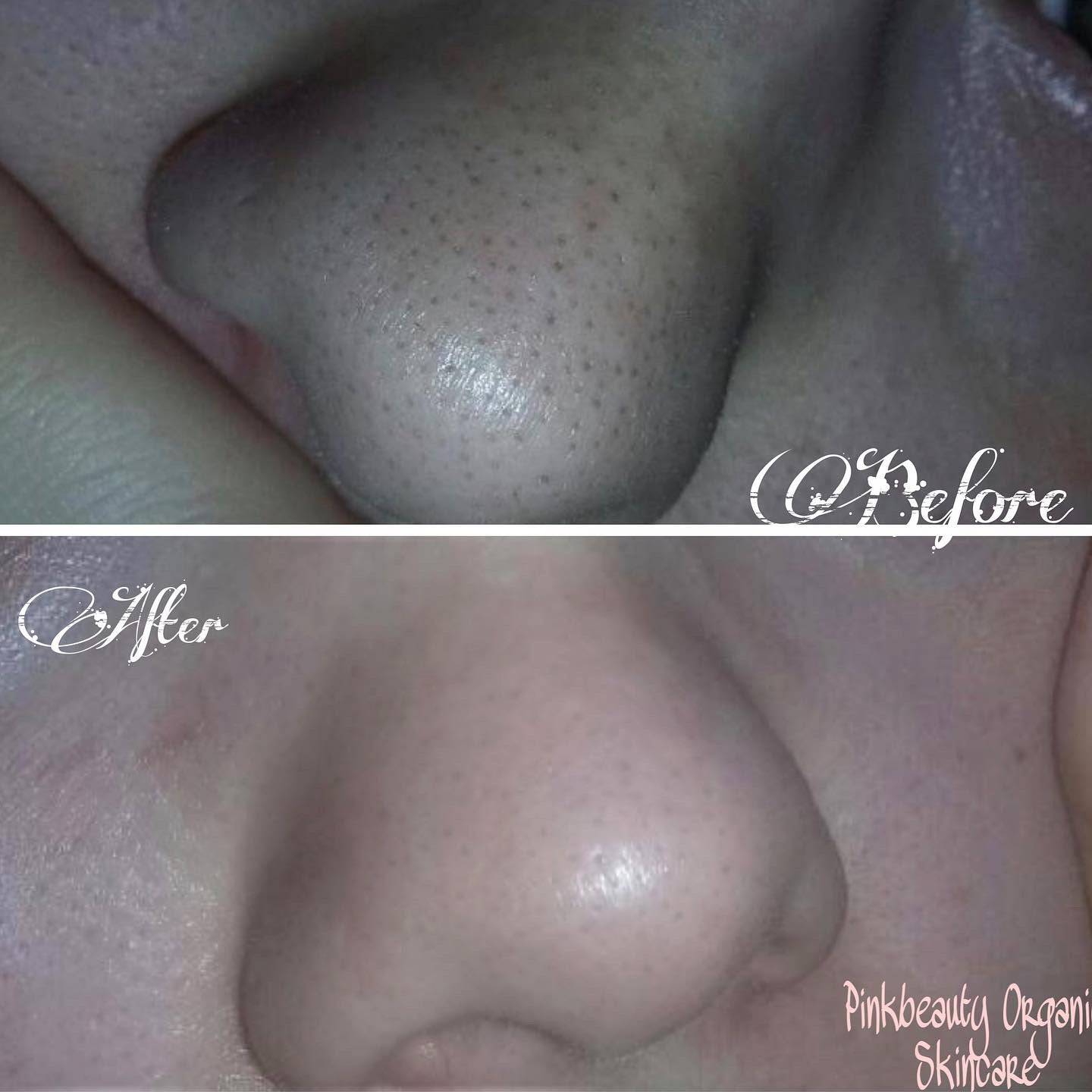 Blemish Buster Whipped Facial Cleanser