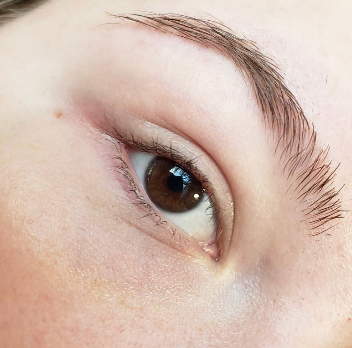 Clarifying MSM Serum