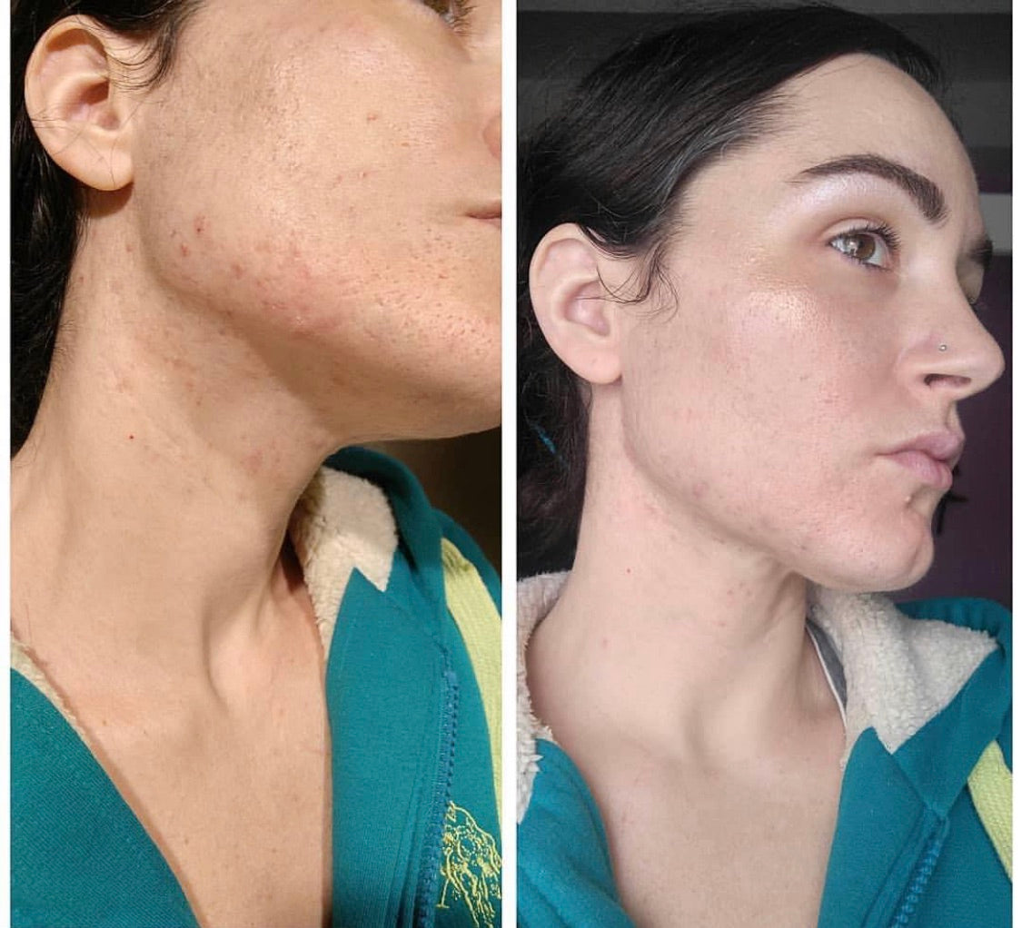 Clarifying MSM Serum