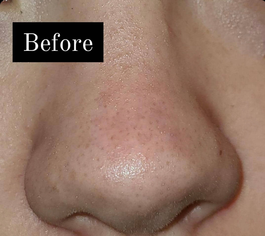 Blemish Buster Whipped Facial Cleanser